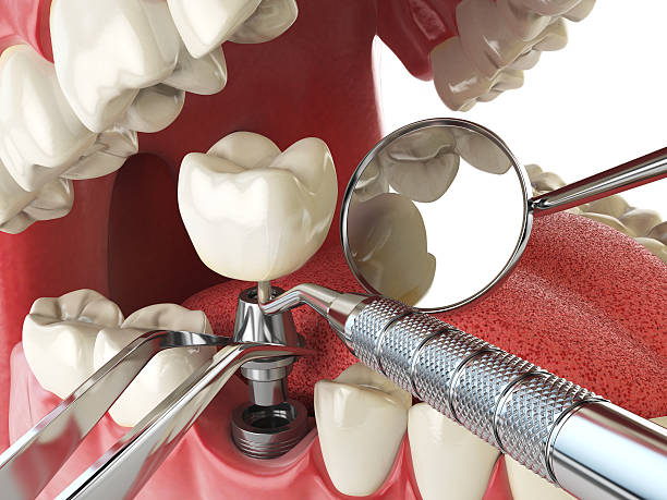 Best Emergency TMJ Treatment in Oak Ridge, FL